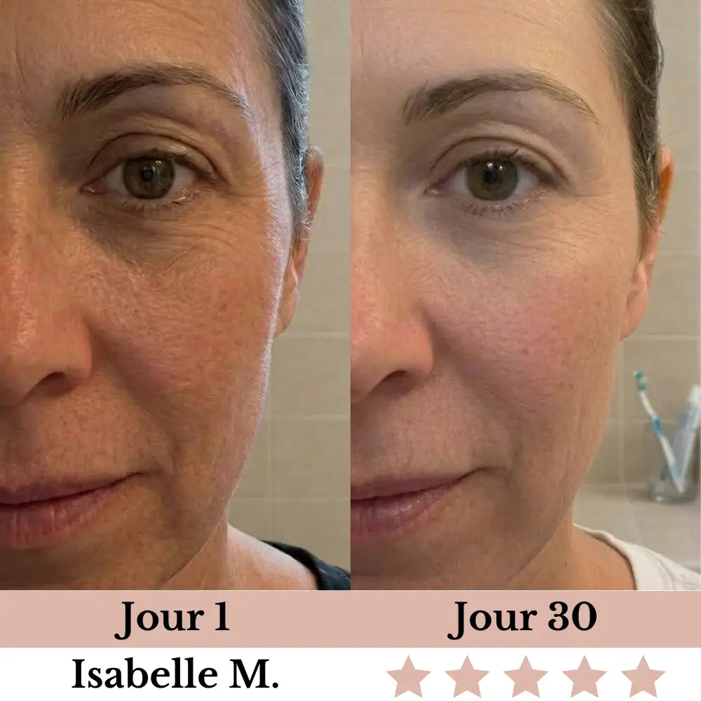 Olynna Skin Sculpteur Facial LED 7-en-1