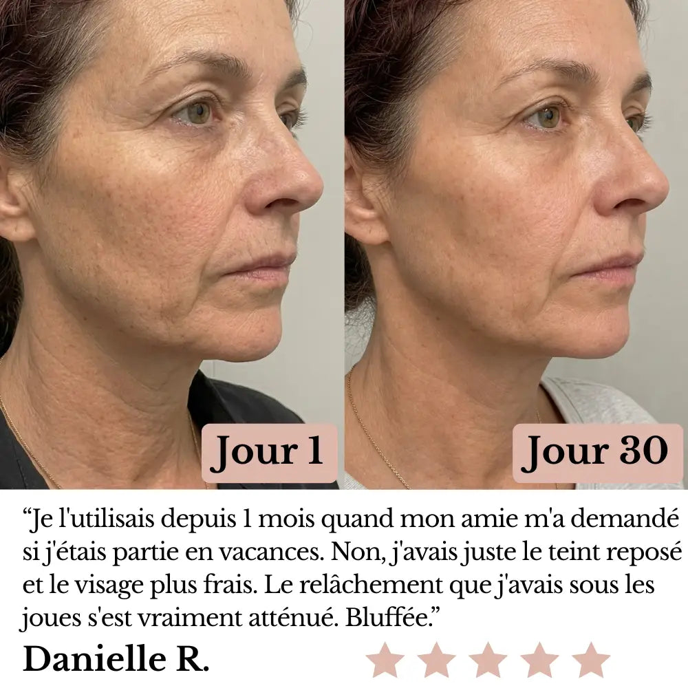 Olynna Skin Sculpteur Facial LED 7-en-1