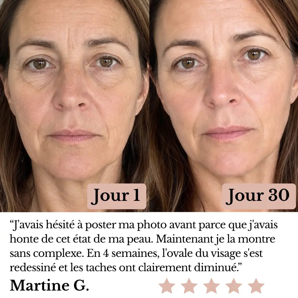 Olynna Skin Sculpteur Facial LED 7-en-1