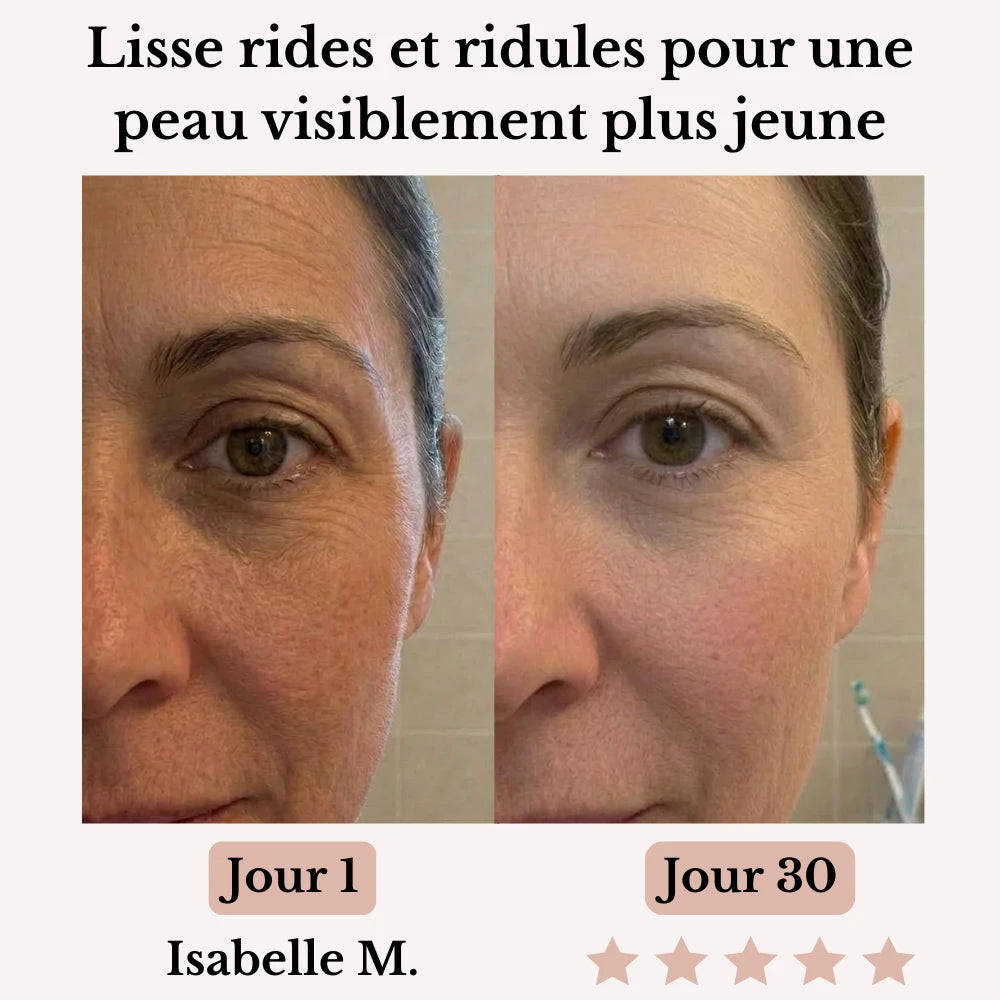Olynna Skin Sculpteur Facial LED 7-en-1