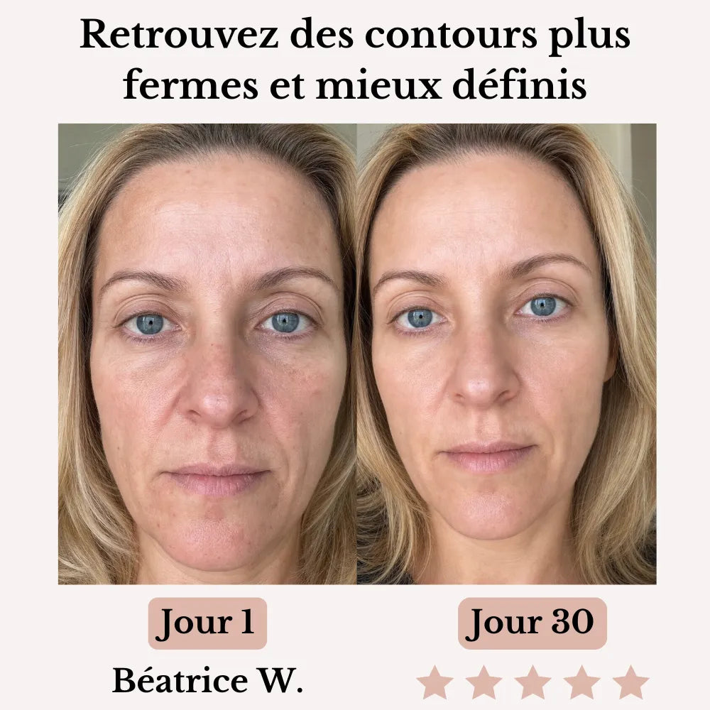 Olynna Skin Sculpteur Facial LED 7-en-1