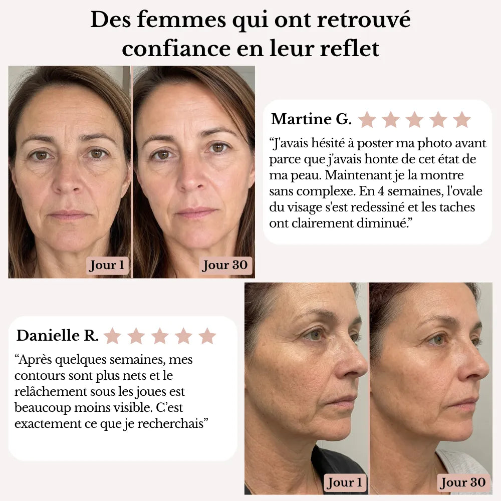 Olynna Skin Sculpteur Facial LED 7-en-1
