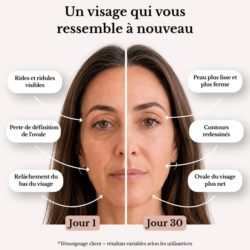 Olynna Skin Sculpteur Facial LED 7-en-1